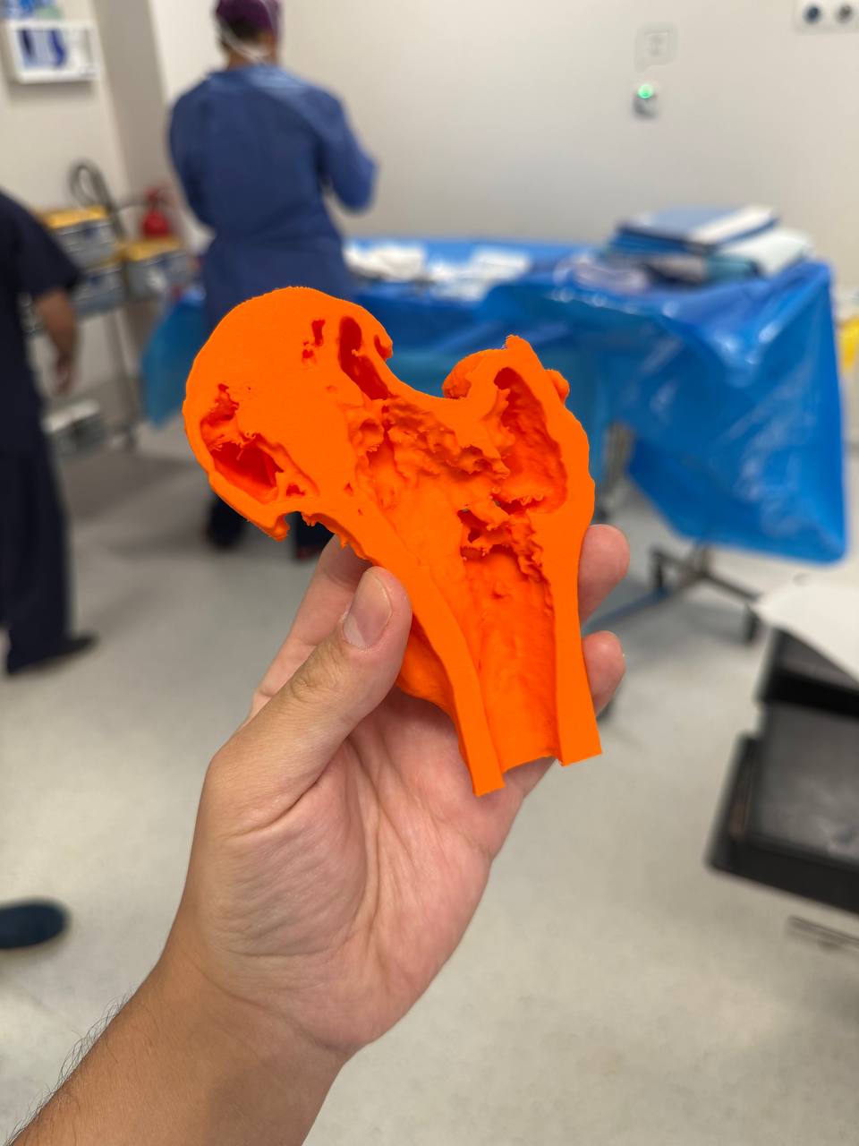 3D preoperative planning model for hip replacement