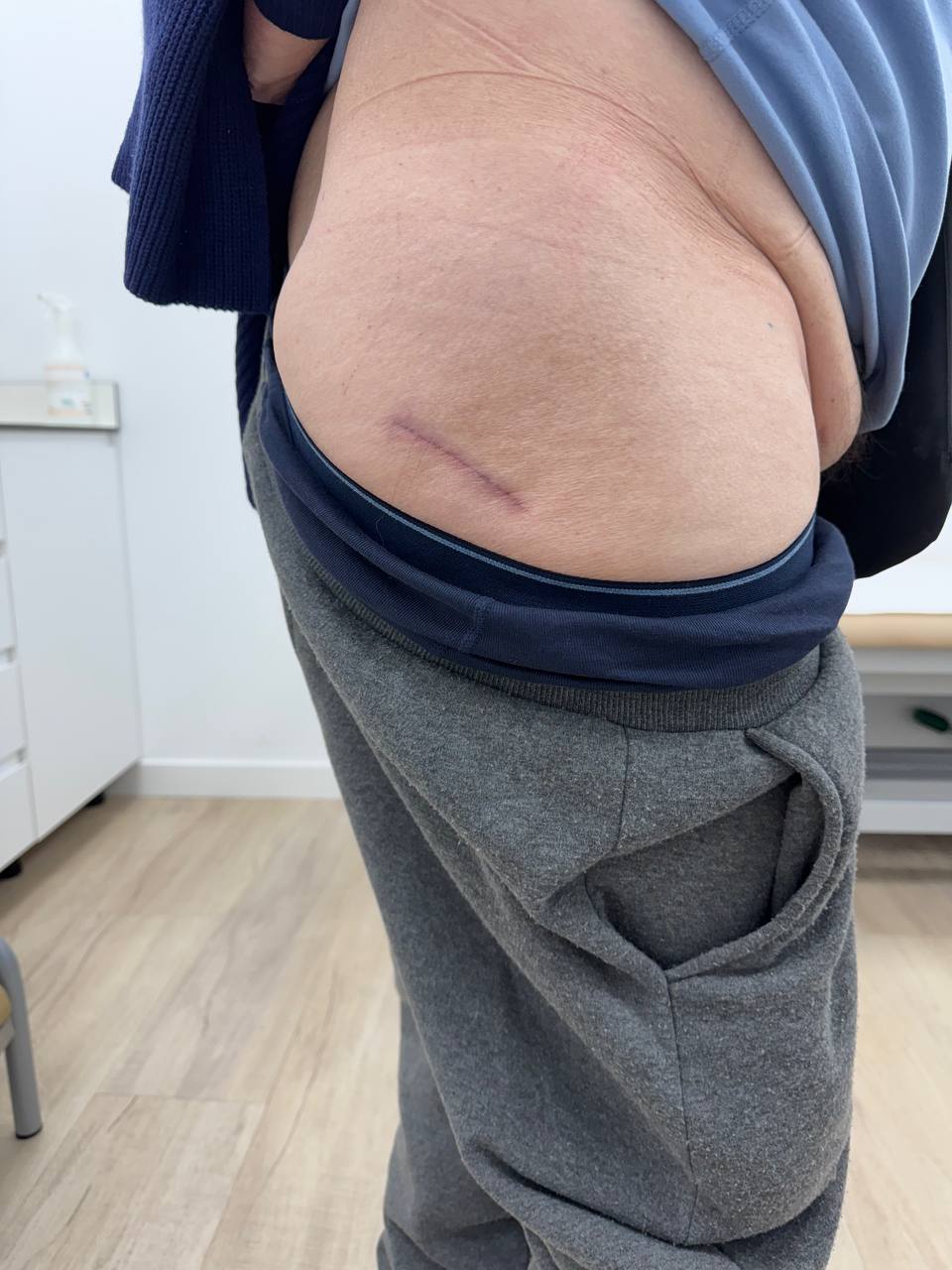 Minimally invasive hip incision