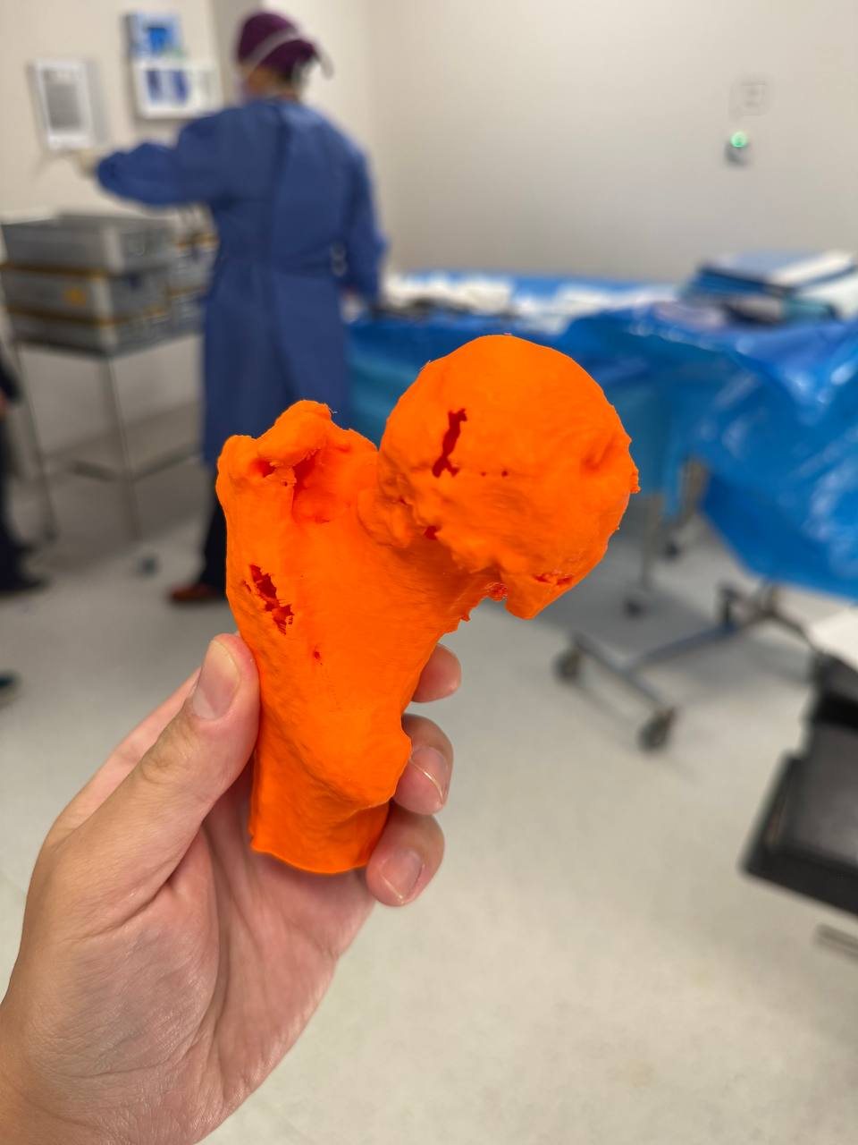 DF Trauma advanced 3D hip surgical planning